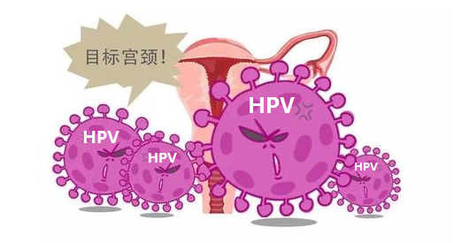 在感染HPV之后，会有哪些症状表现？